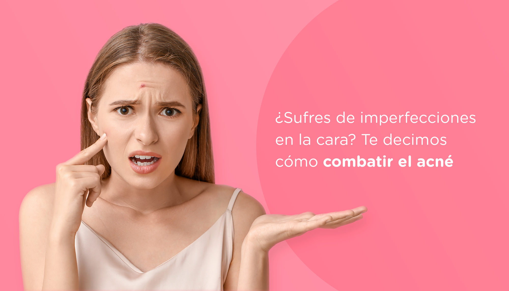 ¿Sufres de imperfecciones en la cara? Te decimos cómo combatir el acné