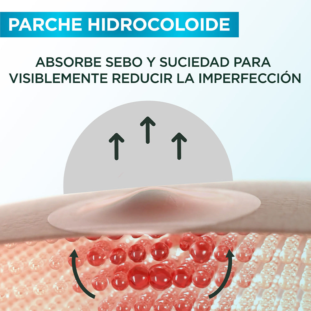 PARCHES PARA ACNÉ - GARNIER SKIN ACTIVE