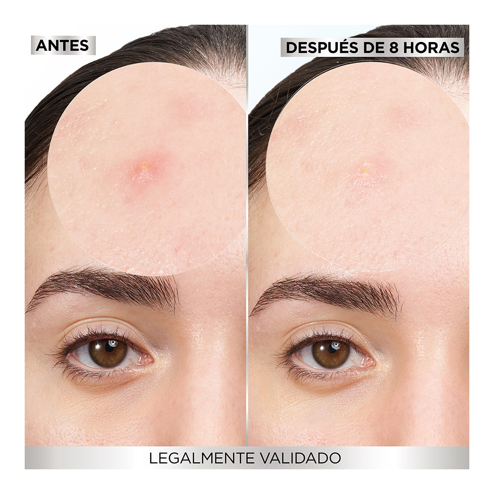 PARCHES PARA ACNÉ 8 PIEZAS - GARNIER SKIN ACTIVE