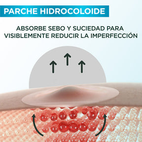 PARCHES PARA ACNÉ - GARNIER SKIN ACTIVE